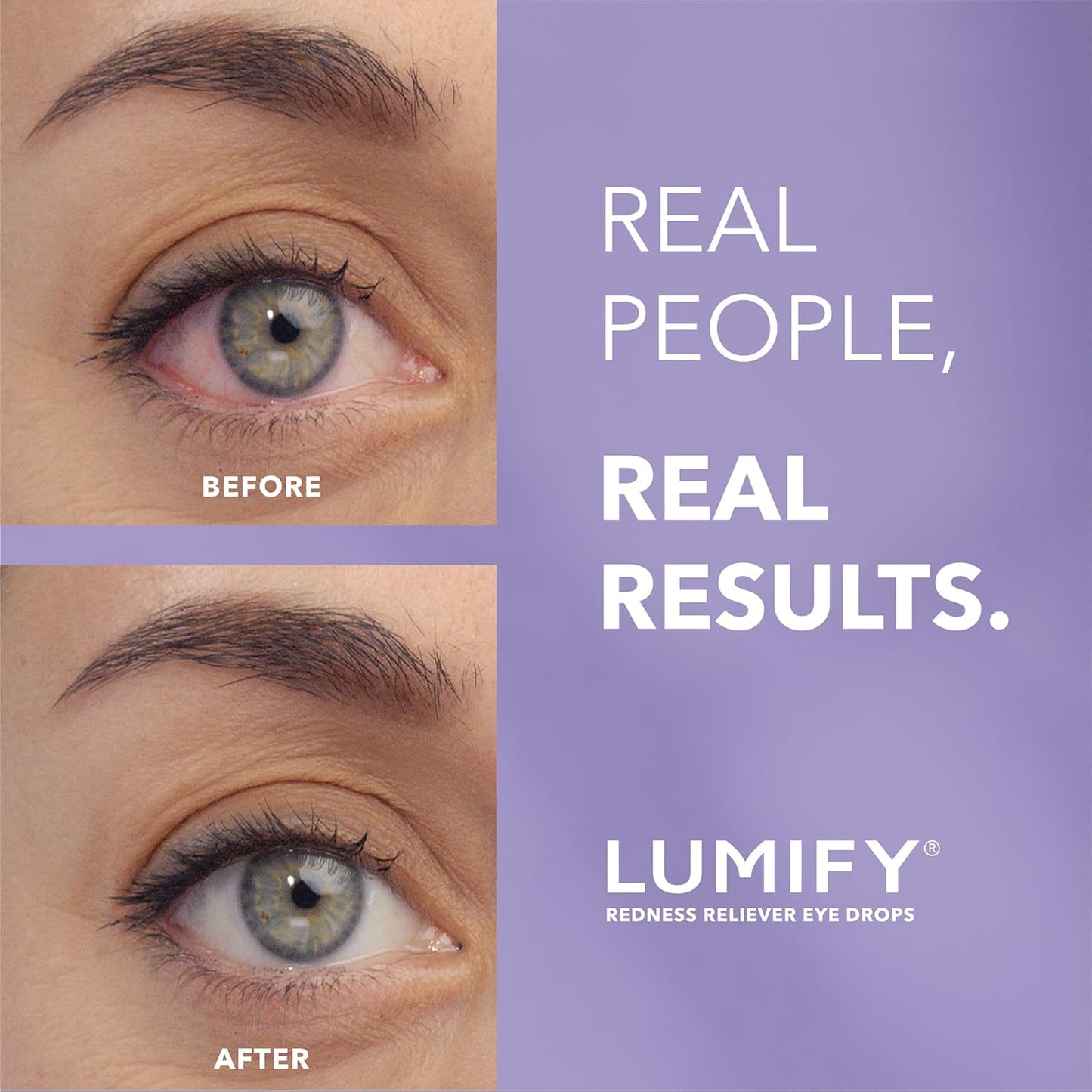 Eye Drops for Red Eyes, Redness Reliever for Brighter Looking Eyes, Works in 1 Minute & Lasts up to 8 Hours, Eye Drops, 0.25 Fl Oz (7.5Ml), Packaging May Vary